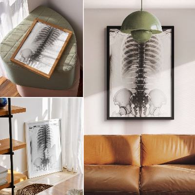Hållbar väggposter Skelett i svart och vitt